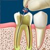 Clinilab Pastor endodoncia